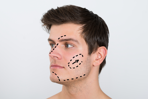 young man with perforation lines marked on face-img-blog