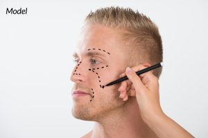 Model Man Getting Plastic Surgery 