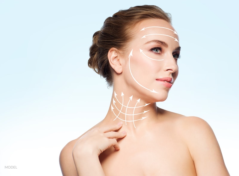 Woman with cosmetic lines drawn on face to represent facial rejuvenation.