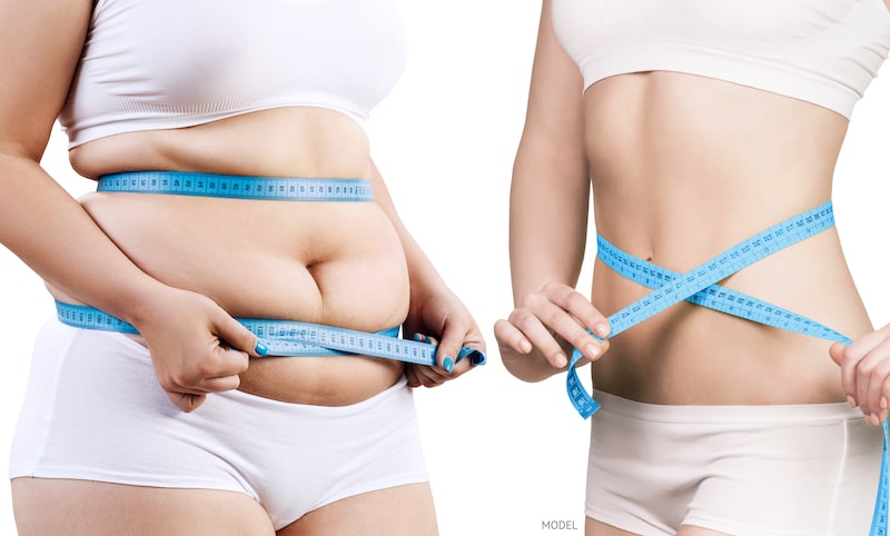 Before and after weight-loss concept with tape measure tied around waists